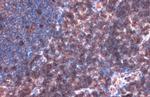 LAT Antibody in Immunohistochemistry (Paraffin) (IHC (P))