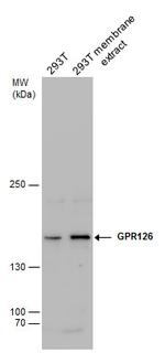 GPR126 Antibody in Western Blot (WB)