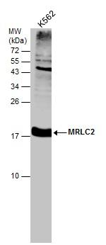 MRLC2 Antibody in Western Blot (WB)