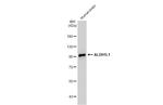 ALDH1L1 Antibody in Western Blot (WB)