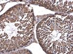 DHX36 Antibody in Immunohistochemistry (Paraffin) (IHC (P))