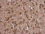 DHX36 Antibody in Immunohistochemistry (Paraffin) (IHC (P))