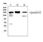 ACE Antibody in Western Blot (WB)