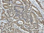 ATP Citrate Lyase Antibody in Immunohistochemistry (Paraffin) (IHC (P))