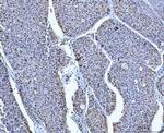 ATP Citrate Lyase Antibody in Immunohistochemistry (Paraffin) (IHC (P))