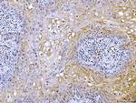 ATP Citrate Lyase Antibody in Immunohistochemistry (Paraffin) (IHC (P))