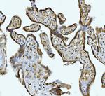 ATP Citrate Lyase Antibody in Immunohistochemistry (Paraffin) (IHC (P))