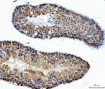 ATP Citrate Lyase Antibody in Immunohistochemistry (Paraffin) (IHC (P))