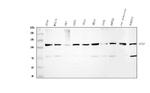 ATP Citrate Lyase Antibody in Western Blot (WB)