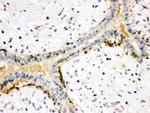 Actin Antibody in Immunohistochemistry (Paraffin) (IHC (P))