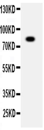 ADAM2 Antibody in Western Blot (WB)