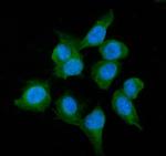 Alcohol Dehydrogenase 1A Antibody in Immunocytochemistry (ICC/IF)