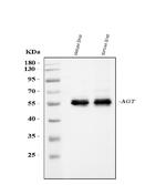 Angiotensinogen Antibody in Western Blot (WB)