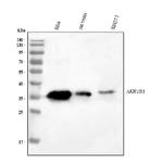 AKR1B1 Antibody in Western Blot (WB)