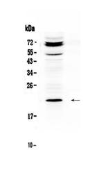 Betatrophin Antibody in Western Blot (WB)