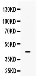 B3GNT8 Antibody in Western Blot (WB)