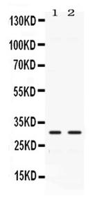 Carbonic Anhydrase III Antibody in Western Blot (WB)