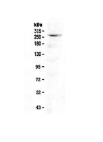 CAD Antibody in Western Blot (WB)