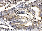 Calpain 2 Antibody in Immunohistochemistry (Paraffin) (IHC (P))