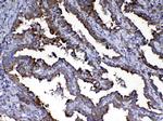 Calpain 2 Antibody in Immunohistochemistry (Paraffin) (IHC (P))