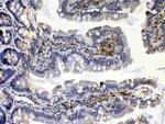 Calpain 2 Antibody in Immunohistochemistry (Paraffin) (IHC (P))