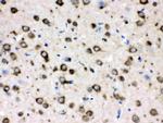 TCP-1 delta Antibody in Immunohistochemistry (Paraffin) (IHC (P))