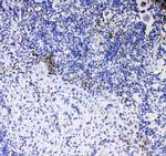 CD8 alpha Antibody in Immunohistochemistry (Paraffin) (IHC (P))