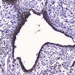 CDK6 Antibody in Immunohistochemistry (Paraffin) (IHC (P))