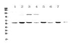 CHRNA3 Antibody in Western Blot (WB)