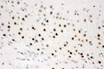 CtBP2 Antibody in Immunohistochemistry (Paraffin) (IHC (P))