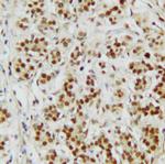 CtBP2 Antibody in Immunohistochemistry (Paraffin) (IHC (P))