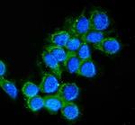 Cathepsin D Antibody in Immunocytochemistry (ICC/IF)