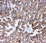 Cathepsin D Antibody in Immunohistochemistry (Paraffin) (IHC (P))