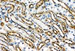 Cathepsin D Antibody in Immunohistochemistry (Paraffin) (IHC (P))