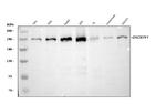 Dicer Antibody in Western Blot (WB)