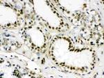 EWSR1 Antibody in Immunohistochemistry (Paraffin) (IHC (P))