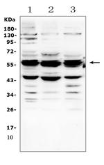 GALNS Antibody in Western Blot (WB)