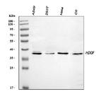 HDGF Antibody in Western Blot (WB)