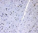 hnRNP L Antibody in Immunohistochemistry (Paraffin) (IHC (P))