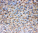 HSD17B1 Antibody in Immunohistochemistry (Paraffin) (IHC (P))