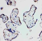 HSD17B1 Antibody in Immunohistochemistry (Paraffin) (IHC (P))