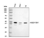 HSD17B1 Antibody in Western Blot (WB)