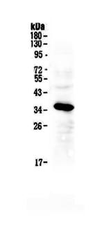 IGFBP2 Antibody in Western Blot (WB)