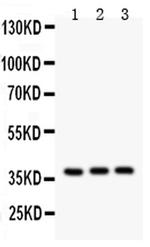 IL-3 Antibody in Western Blot (WB)