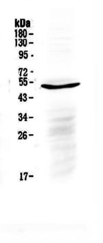 IL-6 Receptor (CD126) Antibody in Western Blot (WB)