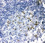 IRF4 Antibody in Immunohistochemistry (Paraffin) (IHC (P))