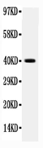 CD104 (Integrin beta 4) Antibody in Western Blot (WB)