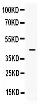 ITLN1 Antibody in Western Blot (WB)