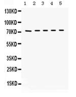 Bradykinin Antibody in Western Blot (WB)