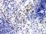 NGAL Antibody in Immunohistochemistry (Paraffin) (IHC (P))